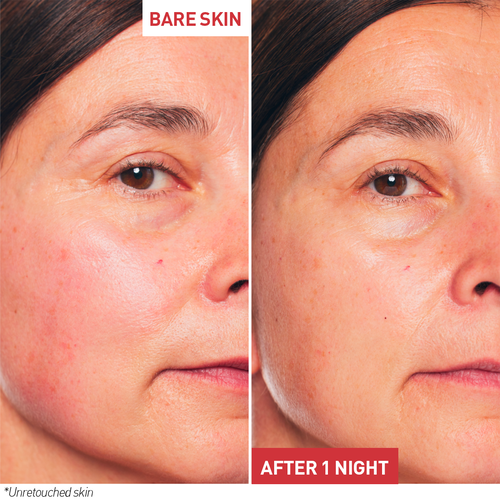 Skin Therapy Oil-Serum 30ml - BEAUTYBERRRY