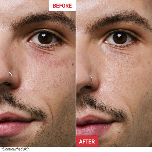 Skin Therapy Eye 15ml - BEAUTYBERRRY