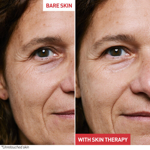 Skin Therapy Milky-Serum - BEAUTYBERRRY