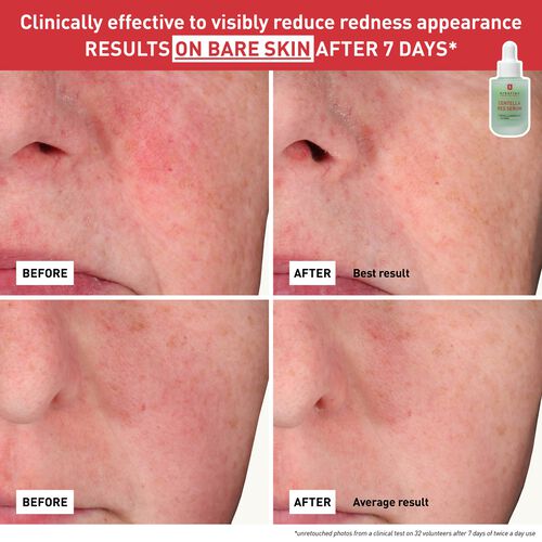 Centella Red Serum - BEAUTYBERRRY 